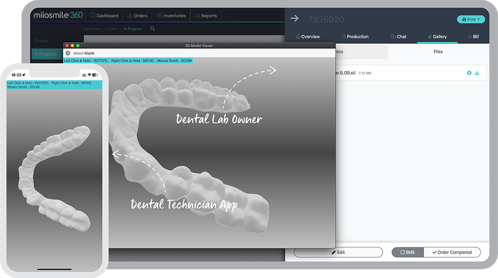 Unlock a range of capabilities: miiosmile360 empowers you to effortlessly collect, store, manage, process, and interpret data across various operational areas with Dental Manufacturing Productivity Software