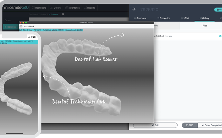 dental lab order form, upload 3D files (stl, ply, obj), video files (mp4) and images (jpg, png). 3D file for dental restoration